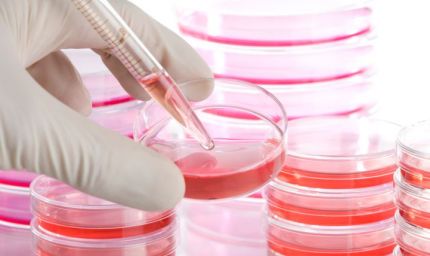 Malattie rare: oltre il 50% è di natura neurologica