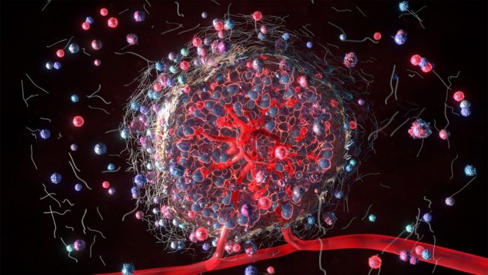 Anelli molecolari coinvolti in rabdomiosarcoma pediatrico