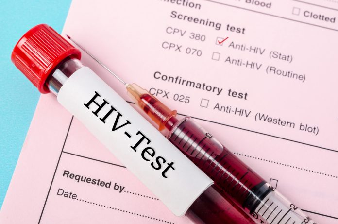 Diagnosi HIV tardiva, serve test sistematico